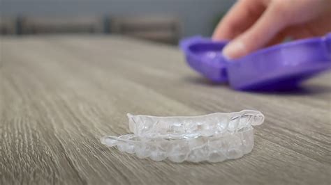 How Much Does a Plastic Retainer Cost?